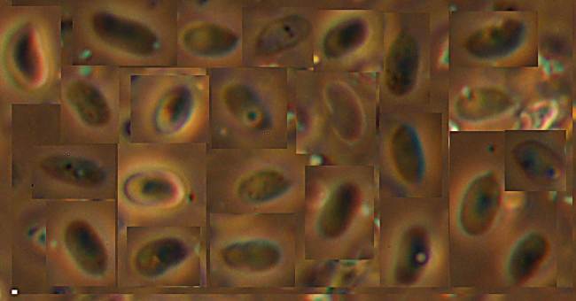 Sullo stesso tronco (Phlebiopsis ravenelii)